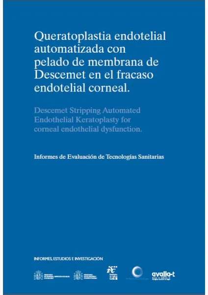  Queratoplastia endotelial automatizada con pelado de membrana de descemet en el fracaso endotelial corneal 