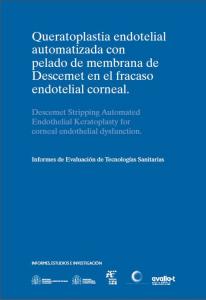 Queratoplastia endotelial automatizada con pelado de membrana de descemet en el fracaso endotelial corneal Queratoplastia endotelial automatizada con pelado de membrana de descemet en el fracaso endotelial corneal