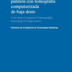 Cribado de cáncer de pulmón con tomografía computarizada de baja dosis