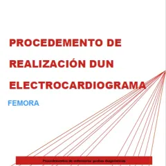 Procedemento de realización dun electrocardiograma: FEMORA
