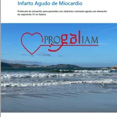 Programa galego de atención ao infarto agudo de miocardio: Protocolo de actuación para pacientes con Síndrome Coronaria Aguda con elevación do segmento ST en Galicia